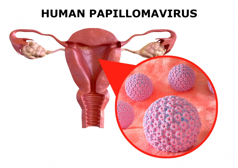 Human Papilomavirus & Cancer | Q-Life Family Clinic